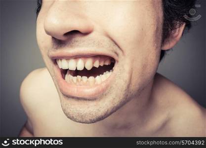 Young man is showing his dirty teeth with plaque buildup
