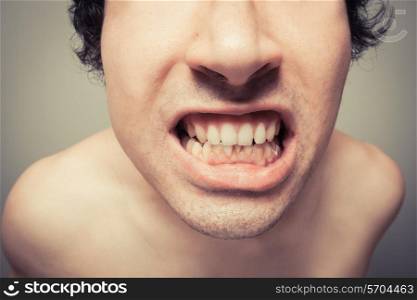 Young man is showing his dirty teeth with plaque buildup