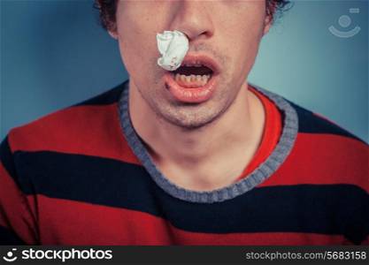 Young man with tissue in his nostril has nose bleed as well as cold sores on his lip