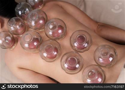 young woman receiving cupping treatment on back