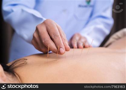 young woman undergoing acupuncture treatment on back