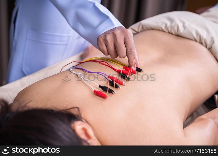 young woman undergoing acupuncture treatment with electrical stimulator on back