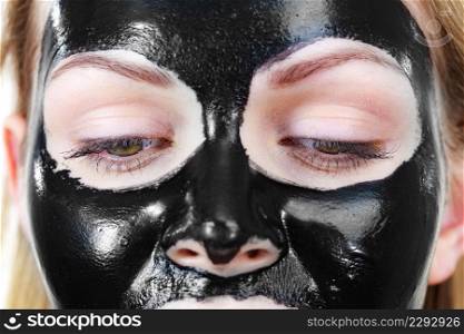 Young woman with carbo detox black peel-off mask on her face, detail view. Teen girl taking care of oily skin, cleaning the pores. Beauty treatment. Skincare.. Girl black carbo peel off mask on face
