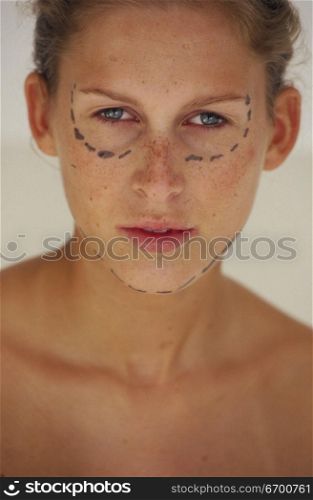 Young woman with guide markings for cosmetic surgery